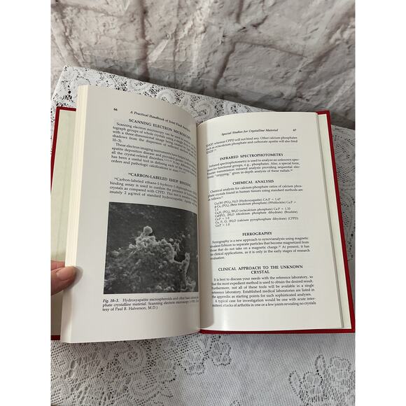 1984 A Practical Handbook of Joint Fluid Analysis by Robert A. Gatter Hardback - Picture 4 of 6